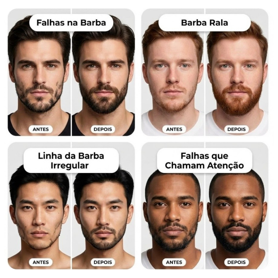 Bountys®  BARBMAX – Caneta de Correção para Falhas na Barba