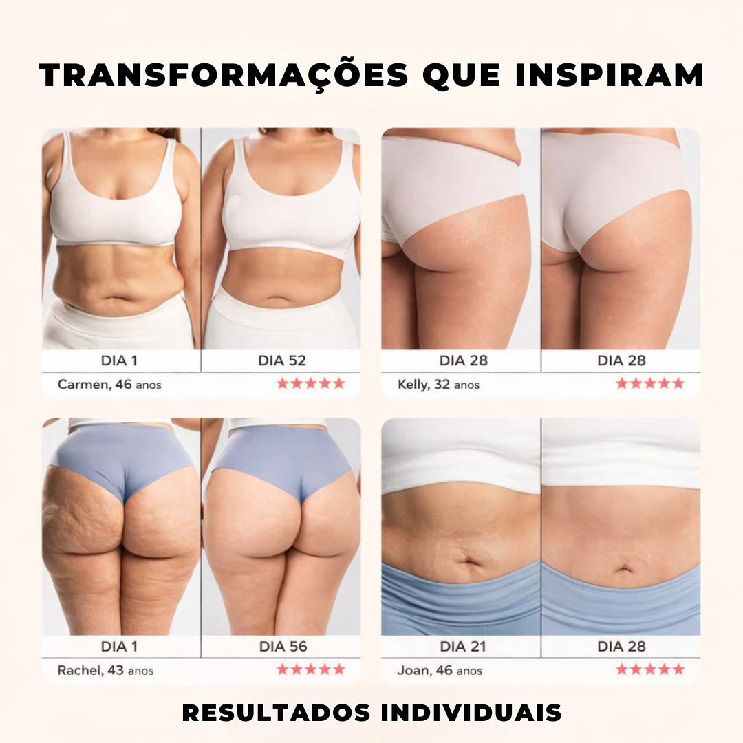 Bountys® Drena Roller – Massageador Linfático para Lipedema e Celulite